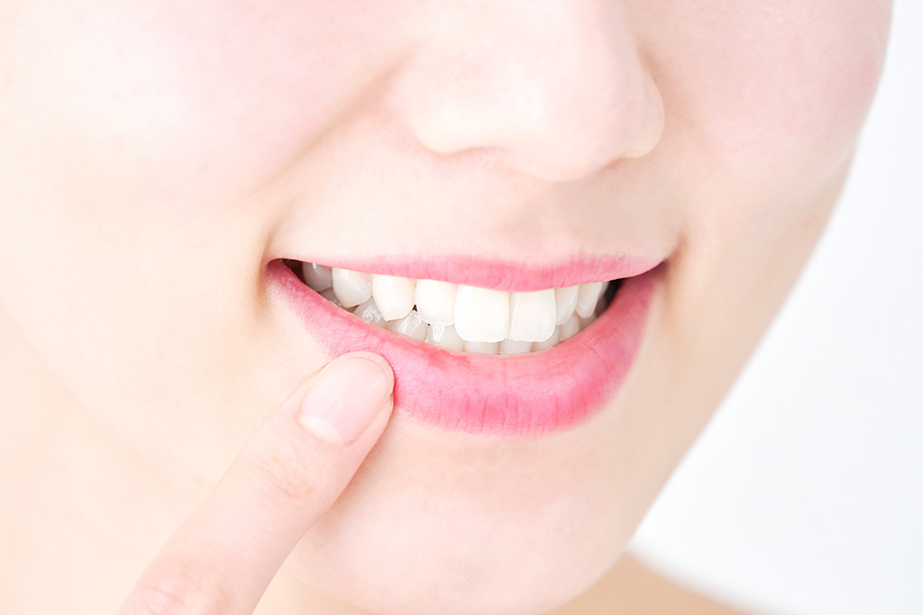 自由診療の被せ物