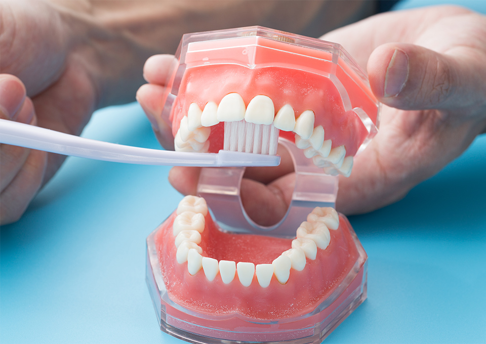 予防・クリーニング