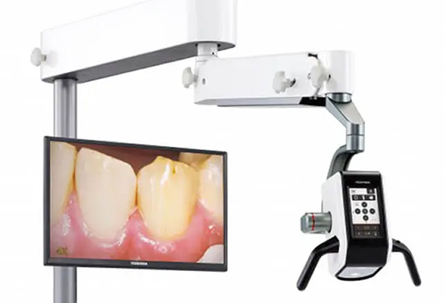 マイクロスコープを用いた精密治療